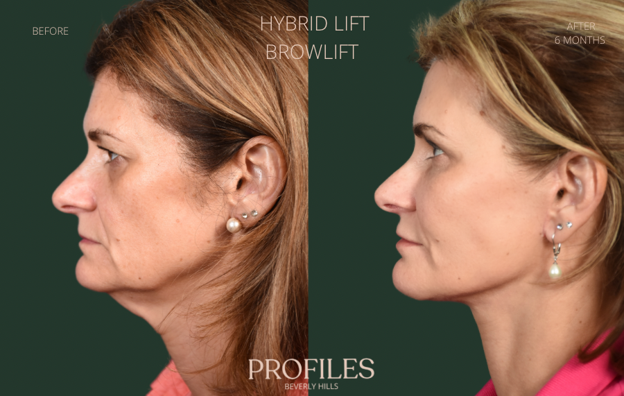 Photo Jun 06 2023, 9 44 51 AM (1)