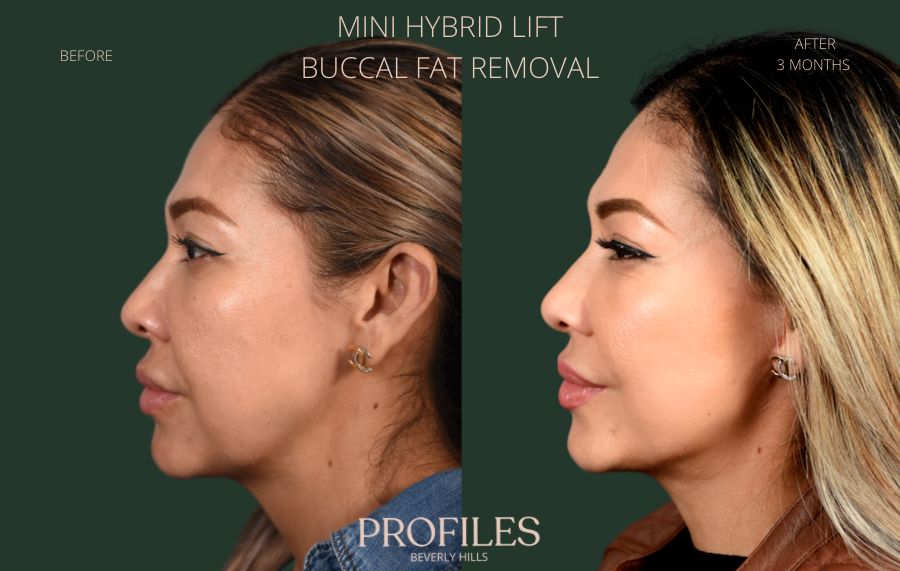 Photo Jun 06 2023, 9 45 33 AM